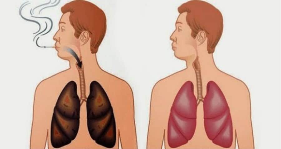 can-you-clean-out-your-lungs-of-tar-and-toxins