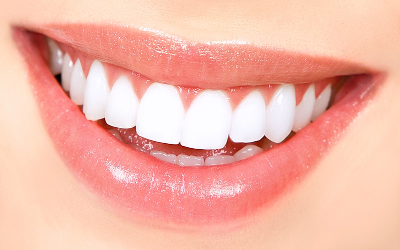 Stained or Discolored Teeth